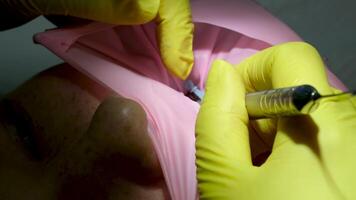 tandheelkunde adolescentie een dokter in geel handschoenen vult een tand van een jong meisje voor een vrouw detailopname in tandheelkunde Bij de tandarts drogen de tand met licht nieuw technologieën modern kliniek video