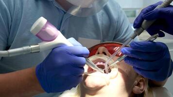 profesional dientes limpieza en un dental clínica, quitando piedras y placa, aplicando pintar a dientes entonces ese un capa de piedras es visible, especial el más nuevo dispositivos en dentistas, azul guantes, azul trajes video