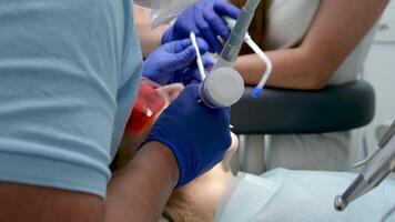 professionnel les dents nettoyage dans une dentaire clinique, enlever des pierres et plaque, appliquant peindre à les dents donc cette une couche de des pierres est visible, spécial plus récent dispositifs dans dentistes, bleu gants, bleu costume video