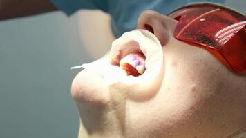 profesional dientes limpieza en un dental clínica, quitando piedras y placa, aplicando pintar a dientes entonces ese un capa de piedras es visible, especial el más nuevo dispositivos en dentistas, azul guantes, azul trajes video