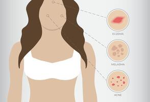 ilustración de eczema, acné y melasma con mujer antecedentes vector