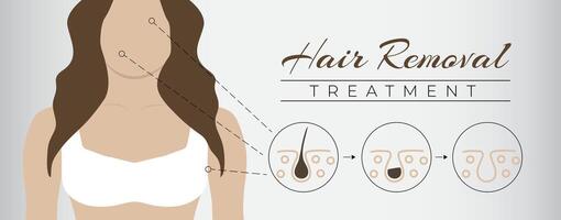 Hair Removal Treatment Banner Illustration Background with Woman vector