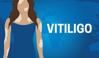 Blue Vitiligo Skin Illness Banner Background vector