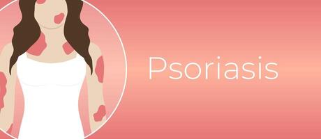 Psoriasis Illness Background Illustration with Woman with Red Skin vector