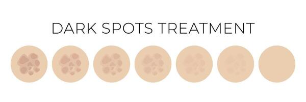 Dark Spots Treatment Isolated Illustration with Whitening or Fading Steps vector