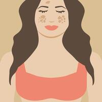 Girl or Woman with Melasma. Pigmentation Spots Illustration Design vector