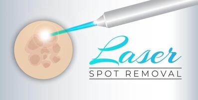 Laser Spot Removal Background Illustration vector