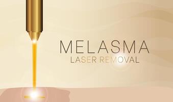 Melasma Laser Removal Background Illustration vector