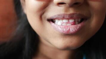 détail coup de enfant avec les dents disparu video