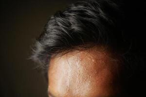 closeup of sweat on forehead against dark background , photo