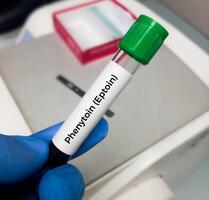 Blood sample for Phenytoin test, therapeutic drug, to maintain a therapeutic level and diagnose potential for toxicity photo