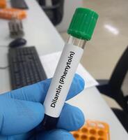 Blood sample for Phenytoin test, therapeutic drug, to maintain a therapeutic level and diagnose potential for toxicity photo