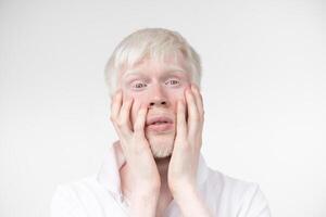 retrato de un albino hombre en estudio vestido camiseta aislado en un blanco antecedentes. anormal desviaciones raro apariencia foto