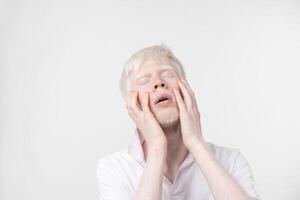 retrato de un albino hombre en estudio vestido camiseta aislado en un blanco antecedentes. anormal desviaciones raro apariencia foto