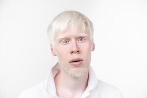 retrato de un albino hombre en estudio vestido camiseta aislado en un blanco antecedentes. anormal desviaciones raro apariencia foto