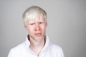 retrato de un albino hombre en estudio vestido camiseta aislado en un blanco antecedentes. anormal desviaciones raro apariencia foto