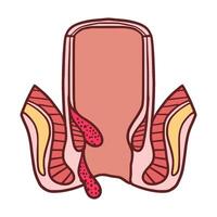 internal and external hemorrhoids illustration vector