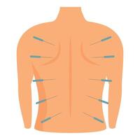 illustration showing acupuncture needles on human back for alternative medicine vector