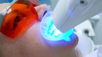 close-up of a woman's face under the apparatus Beyond Poluse Plus Advanced Whitening System with Dental UV Laser Whitening Device in glasses protective against ultraviolet whitening teeth video