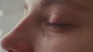 Eyes of a crying girl with a trace of tears. The girl smiles happily and cries with happiness. video