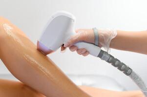 photo epilation - close up of hair removal procedure on legs in salon