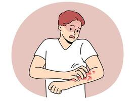 Unhealthy man scratch redness on arms vector