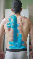 Male Athletic Back with Kinesio Tape After Sports Massage and Vacuum Therapy video