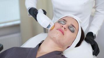 Broadband laser for face rejuvenation video