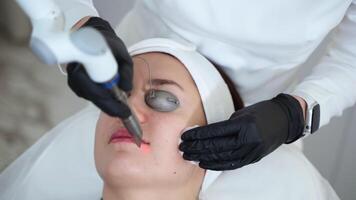 Lips rejuvenation with YAG laser at cosmetology clinic video