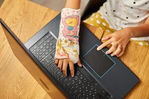 Teen girl with a broken arm orthopedic cast studying online photo