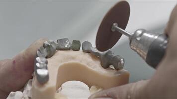 The Metal Infrastructure of Prosthetic Implant Teeth is Shaped video