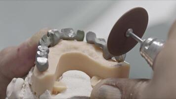 de metall infrastruktur av protes- implantera tänder är formad video