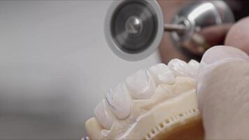 protético implantar dentes estão em forma video