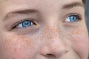 Close-up photo. Body part. Young happy and joyful face in freckles, blue eyes of a child, teenager, looking away. photo