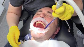 tandheelkundig behandeling door tandarts vrouw tandarts is behandelen een geduldig in tandheelkundig kliniek. tandheelkundig controleren omhoog. stomatoloog behandelt cariës in patiënten tanden video