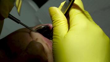 Zahnarzt Hände geben Betäubung Injektion zu weiblich geduldig während Dental Verfahren im Klinik. Arzt Herstellung Betäubung Injektion zu Frau im Zahnheilkunde Büro. Dental Behandlung Konzept. Nahansicht. video