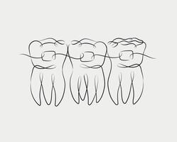 Teeth with braces illustration drawing in linear style on beige background vector