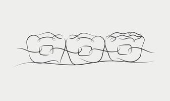 Teeth braces illustration drawing in linear style on white color background vector