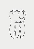 Tooth with dental filling in linear style drawing on white background vector