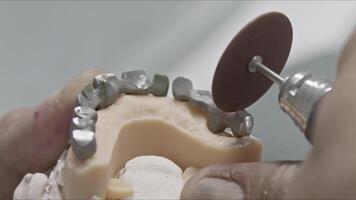 Stages of Implant Teeth Manufacturing in the Dental Laboratory video