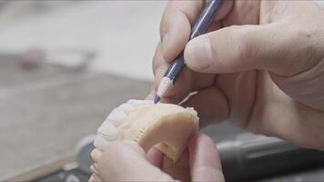 Prosthetic Implant Teeth Are Shaped video