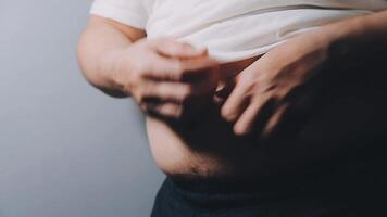 Man pointing own unhealthy big belly with visceral or subcutaneous fats. Pose health risk. video