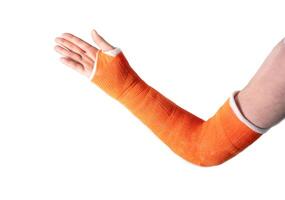 hand in an orange fiberglass cast after a fracture of the wrist bones for fixation on a white background, modern methods of treatment, high quality photo