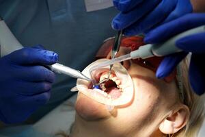 Professional tooth cleaning Dentist with assistant under microscope treats the patient's teeth. Modern progressive dentistry. photo