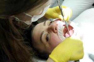 dentista y paciente en dentista oficina un dentista en negro ropa y amarillo guantes con un espejo y herramientas en su manos examina el del paciente dientes en el dental oficina dental tratamiento foto