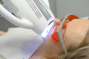 close-up of a woman's face under the apparatus Beyond Poluse Plus Advanced Whitening System with Dental UV Laser Whitening Device in glasses protective against ultraviolet whitening teeth photo