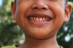 close up headshot cropped of a smiling child showing his healthy teeth photo