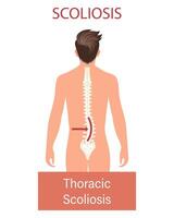 escoliosis, un enfermedad de el columna vertebral. infografía bandera con escoliosis de el humano columna vertebral. cuidado de la salud y medicamento. ilustración vector