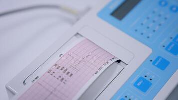 cœur vérifier en haut résultat produit par électrocardiographe. proche en haut. médical équipement travail dans hôpital. video