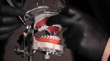 Close-up of orthodontist working on dental model with braces. Orthodontist wearing gloves working on a dental model with braces. video